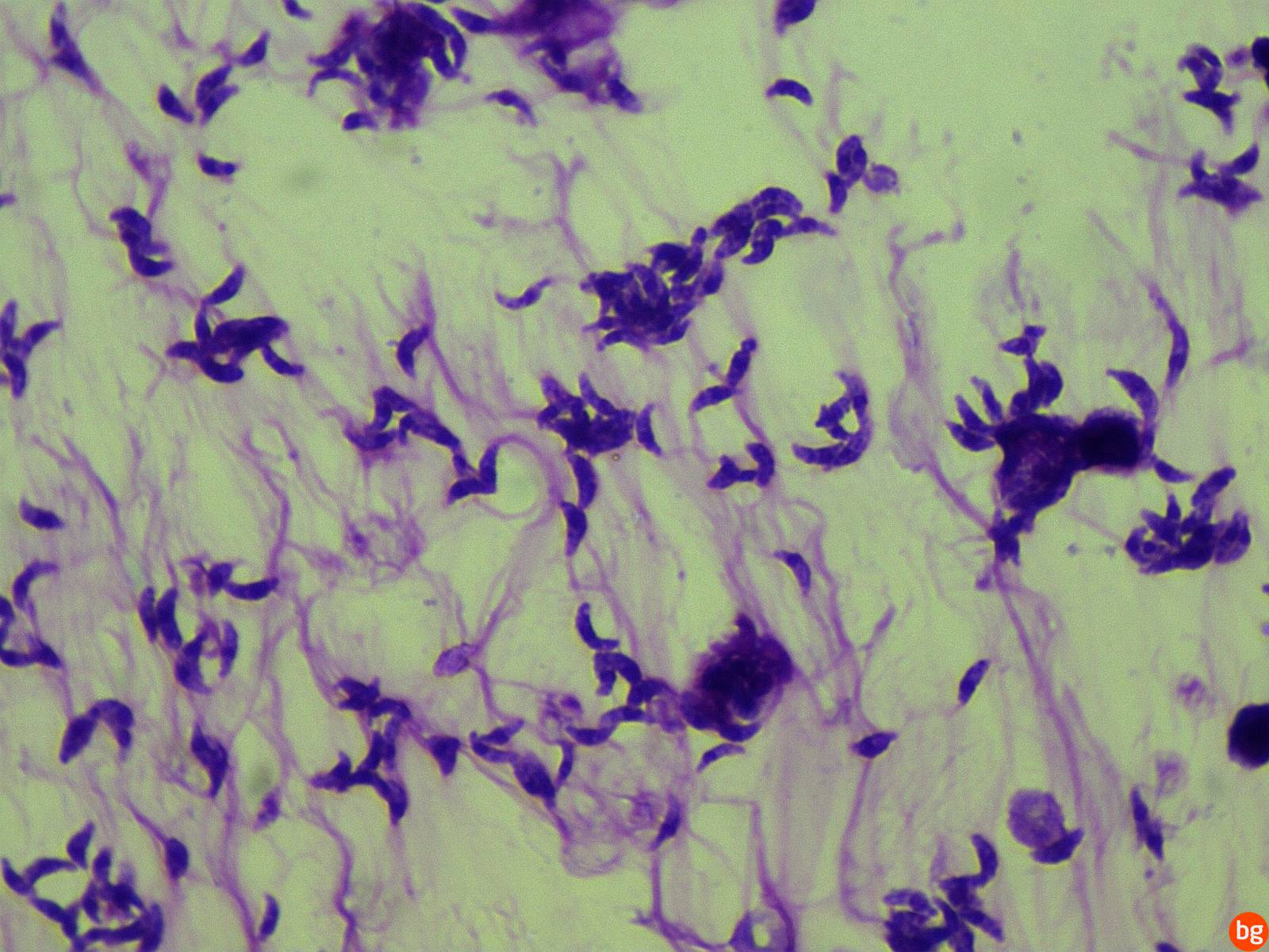 Клетка паразита. Toxoplasma gondii Романовскому Гимзе. Токсоплазма возбудитель токсоплазмоза микроскоп.